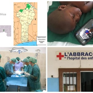 Un 'Abbraccio' grande che parte da Imperia e arriva in Africa: donato un ecografo portatile all'ospedale pediatrico nel Benin